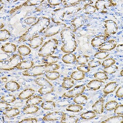 Invitrogen NUBP1 Polyclonal Antibody 100 μL; Unconjugated:Antibodies,