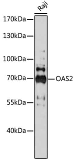 Invitrogen OAS2 Polyclonal Antibody 100 μL; Unconjugated:Antibodies,
