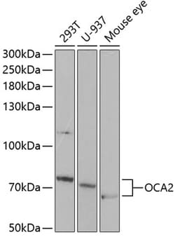 Invitrogen OCA2 Polyclonal Antibody 100 μL; Unconjugated:Antibodies,