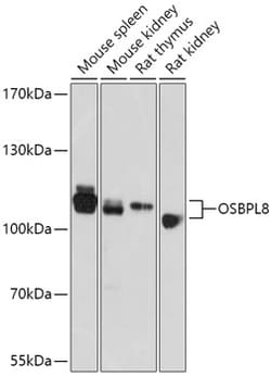 Invitrogen ORP8 Polyclonal Antibody 100 &mu;L; Unconjugated:Antibodies,