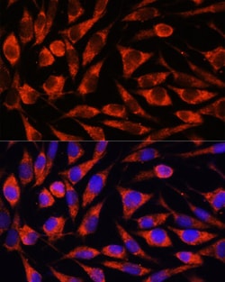 Invitrogen OTUD7B Polyclonal Antibody 100 &mu;L; Unconjugated:Antibodies,