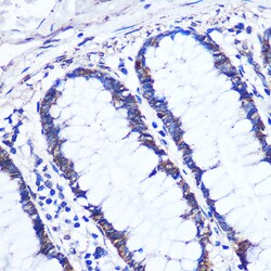 Invitrogen OTUD7B Polyclonal Antibody 100 &mu;L; Unconjugated:Antibodies,