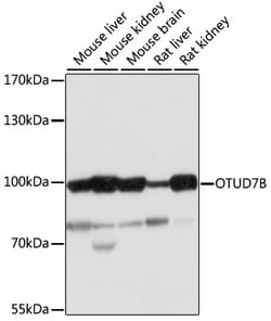 Invitrogen OTUD7B Polyclonal Antibody 100 &mu;L; Unconjugated:Antibodies,