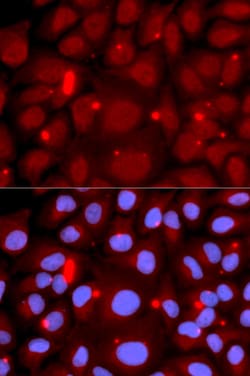 Invitrogen PADI4 Polyclonal Antibody 100 μL; Unconjugated:Antibodies,