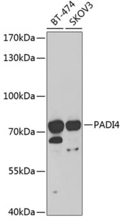 Invitrogen PADI4 Polyclonal Antibody 100 μL; Unconjugated:Antibodies,