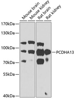 PCDHA13 Polyclonal Antibody, Invitrogen 100 &mu;L; Unconjugated:Antibodies,