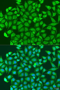 Invitrogen PCDHA6 Polyclonal Antibody 100 μL; Unconjugated:Antibodies,
