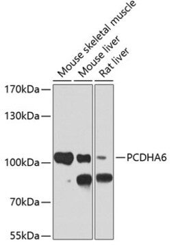 Invitrogen PCDHA6 Polyclonal Antibody 100 μL; Unconjugated:Antibodies,