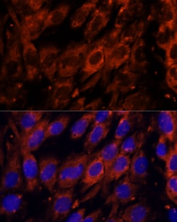 Invitrogen PDE6G Polyclonal Antibody 100 μL; Unconjugated:Antibodies,