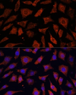 Invitrogen PDE6G Polyclonal Antibody 100 μL; Unconjugated:Antibodies,