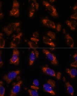 Invitrogen PDE6G Polyclonal Antibody 100 μL; Unconjugated:Antibodies,