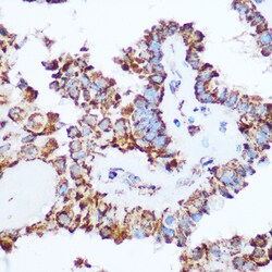 Invitrogen PDHA1 Polyclonal Antibody 100 &mu;L; Unconjugated:Antibodies,