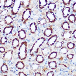 Invitrogen PDHA1 Polyclonal Antibody 100 &mu;L; Unconjugated:Antibodies,