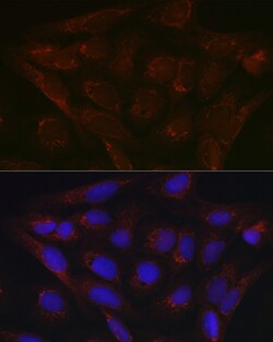 Invitrogen PDK4 Polyclonal Antibody 100 &mu;L; Unconjugated:Antibodies,