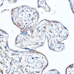 Invitrogen PDK4 Polyclonal Antibody 100 &mu;L; Unconjugated:Antibodies,