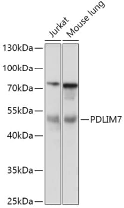 Invitrogen PDLIM7 Polyclonal Antibody 100 &mu;L; Unconjugated:Antibodies,