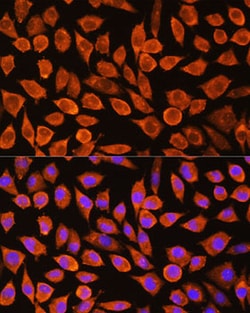 Invitrogen PDXP Polyclonal Antibody 100 μL; Unconjugated:Antibodies,