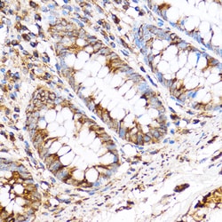 Invitrogen PDXP Polyclonal Antibody 100 μL; Unconjugated:Antibodies,