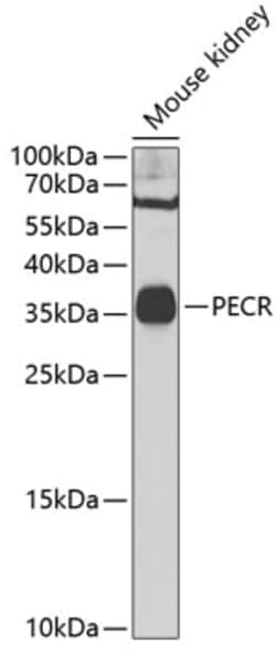 Invitrogen PECR Polyclonal Antibody 100 &mu;L; Unconjugated:Antibodies,