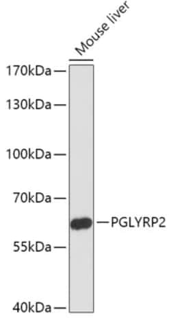 Invitrogen PGRP-L Polyclonal Antibody 100 &mu;L; Unconjugated:Antibodies,