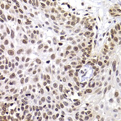 Invitrogen PHIP Polyclonal Antibody 100 &mu;L; Unconjugated:Antibodies,