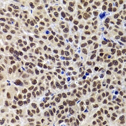 Invitrogen PHIP Polyclonal Antibody 100 &mu;L; Unconjugated:Antibodies,