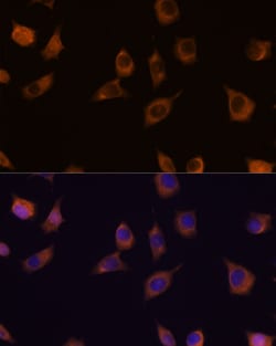 Invitrogen PHLPP2 Polyclonal Antibody 100 &mu;L; Unconjugated:Antibodies,