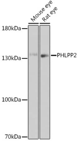 Invitrogen PHLPP2 Polyclonal Antibody 100 &mu;L; Unconjugated:Antibodies,