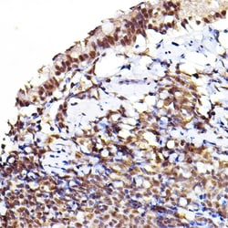 Invitrogen Phospho-AKT1/AKT2/AKT3 (Ser473) Polyclonal Antibody 100 &mu;L;