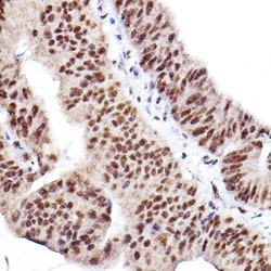 Invitrogen Phospho-AKT1/AKT2/AKT3 (Ser473) Polyclonal Antibody 100 &mu;L;