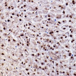 Invitrogen Phospho-AKT1/AKT2/AKT3 (Ser473) Polyclonal Antibody 100 &mu;L;