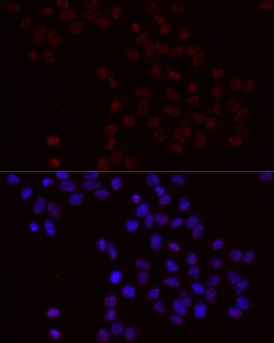 Phospho-BCL2 (Ser70) Polyclonal Antibody:Antibodies, Polyclonal