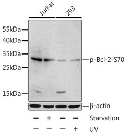 Phospho-BCL2 (Ser70) Polyclonal Antibody:Antibodies, Polyclonal