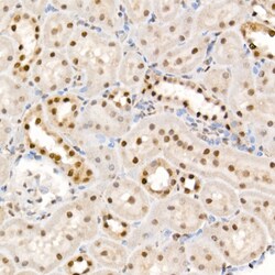 Invitrogen Phospho-4EBP1 (Thr37, Thr46) Polyclonal Antibody 100 &mu;L;