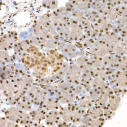 Invitrogen Phospho-4EBP1 (Thr37, Thr46) Polyclonal Antibody 100 &mu;L;