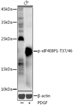 Invitrogen Phospho-4EBP1 (Thr37, Thr46) Polyclonal Antibody 100 &mu;L;