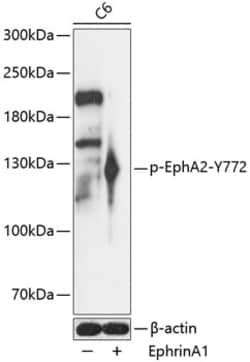Invitrogen Phospho-EphA2 (Tyr772) Polyclonal Antibody 100 &mu;L; Unconjugated:Antibodies,