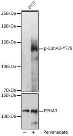 Invitrogen Phospho-EphA3 (Tyr779) Polyclonal Antibody 100 &mu;L; Unconjugated:Antibodies,