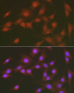 Phospho-FOXO1 (Ser256) Polyclonal Antibody, Invitrogen 100 &mu;L; Unconjugated:Antibodies,