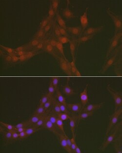 Phospho-FOXO1 (Ser256) Polyclonal Antibody, Invitrogen 100 &mu;L; Unconjugated:Antibodies,