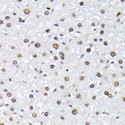 Invitrogen Phospho-FOXO1/FOXO3/FOXO4 (Thr24, Thr32, Thr28) Polyclonal Antibody 100 &mu;L | Buy Online | Invitrogen&trade; | Fisher Scientific