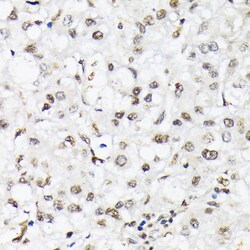 Invitrogen Phospho-FOXO1/FOXO3/FOXO4 (Thr24, Thr32, Thr28) Polyclonal Antibody 100 &mu;L | Buy Online | Invitrogen&trade; | Fisher Scientific