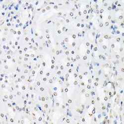 Invitrogen Phospho-FOXO1/FOXO3/FOXO4 (Thr24, Thr32, Thr28) Polyclonal Antibody 100 &mu;L | Buy Online | Invitrogen&trade; | Fisher Scientific