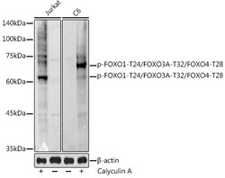 Invitrogen Phospho-FOXO1/FOXO3/FOXO4 (Thr24, Thr32, Thr28) Polyclonal Antibody 100 &mu;L | Buy Online | Invitrogen&trade; | Fisher Scientific