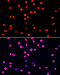 Invitrogen Phospho-Histone H3 (Ser10, Thr11) Polyclonal Antibody 100 &mu;L;