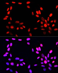 Invitrogen Phospho-Histone H3 (Ser10, Thr11) Polyclonal Antibody 100 &mu;L;