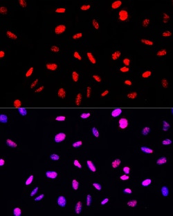 Invitrogen Phospho-Histone H3 (Ser10, Thr11) Polyclonal Antibody 100 &mu;L;