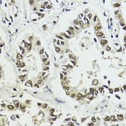 Invitrogen Phospho-Histone H3 (Ser10, Thr11) Polyclonal Antibody 100 &mu;L;