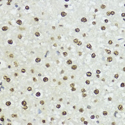 Invitrogen Phospho-Histone H3 (Ser10, Thr11) Polyclonal Antibody 100 &mu;L;