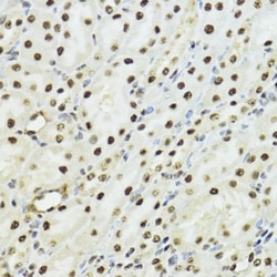 Invitrogen Phospho-Histone H3 (Ser10, Thr11) Polyclonal Antibody 100 &mu;L;